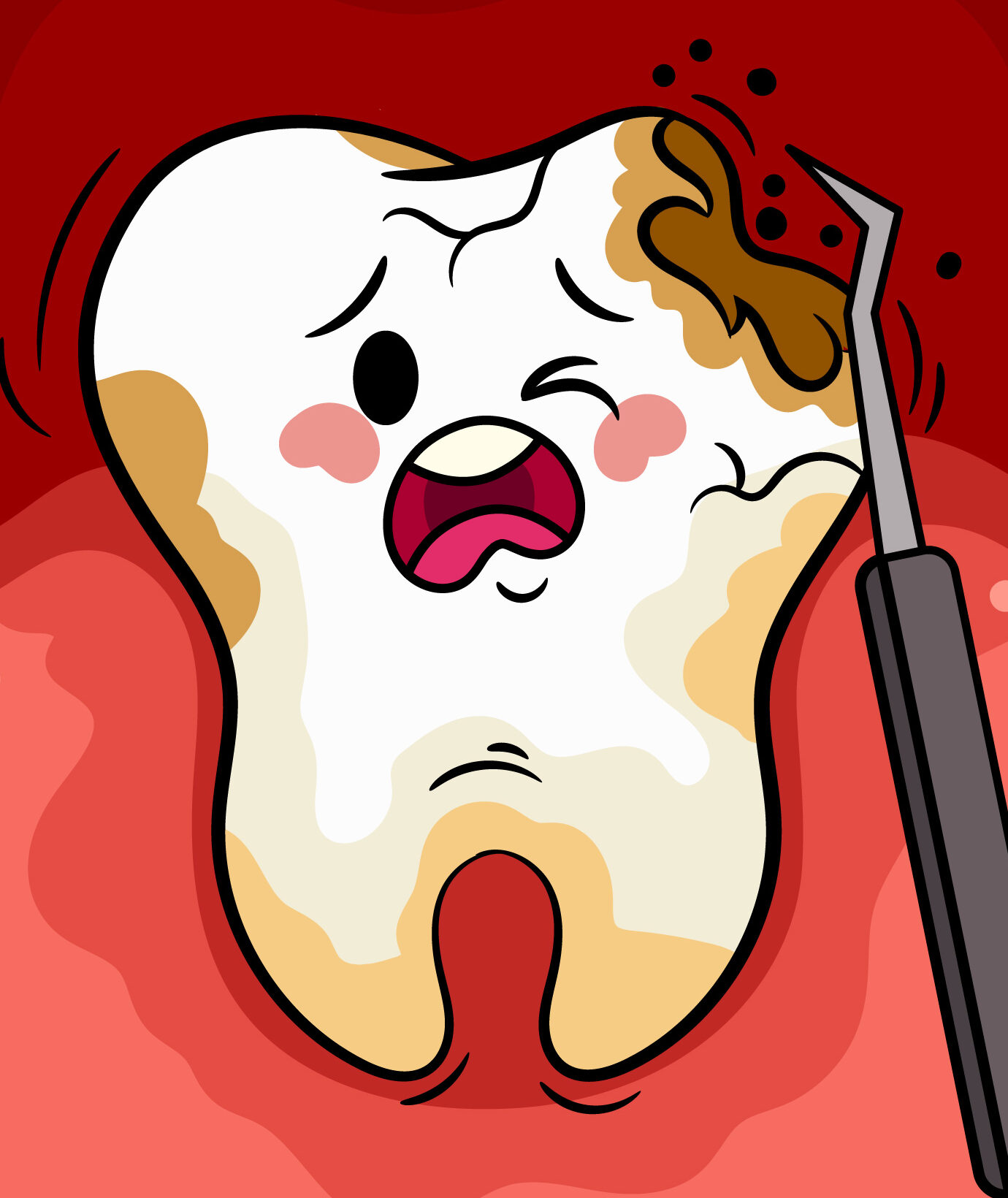 Gum disease image scraping off tarter